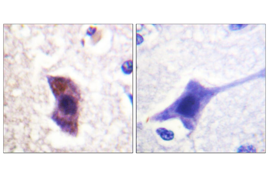 Immunohistochemistry - Anti-HRS (phospho Tyr334) Antibody (A1044) - Antibodies.com