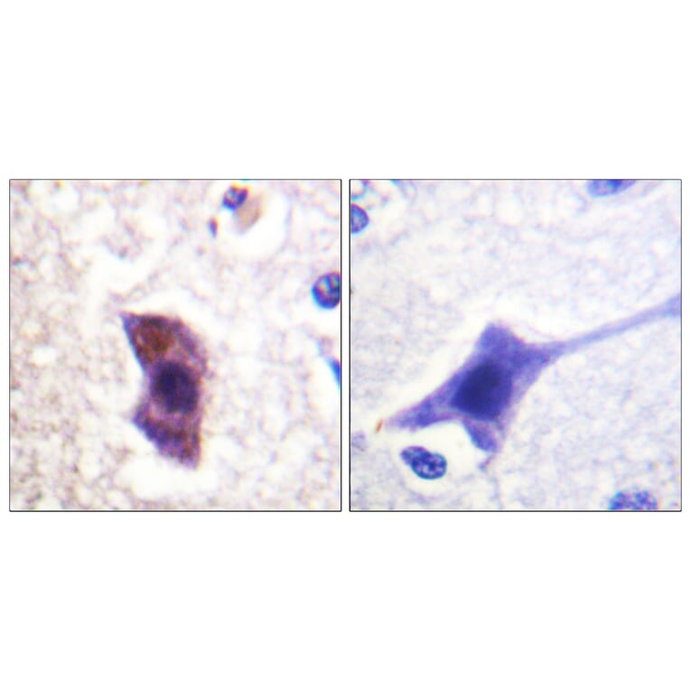 Immunohistochemistry - Anti-HRS (phospho Tyr334) Antibody (A1044) - Antibodies.com