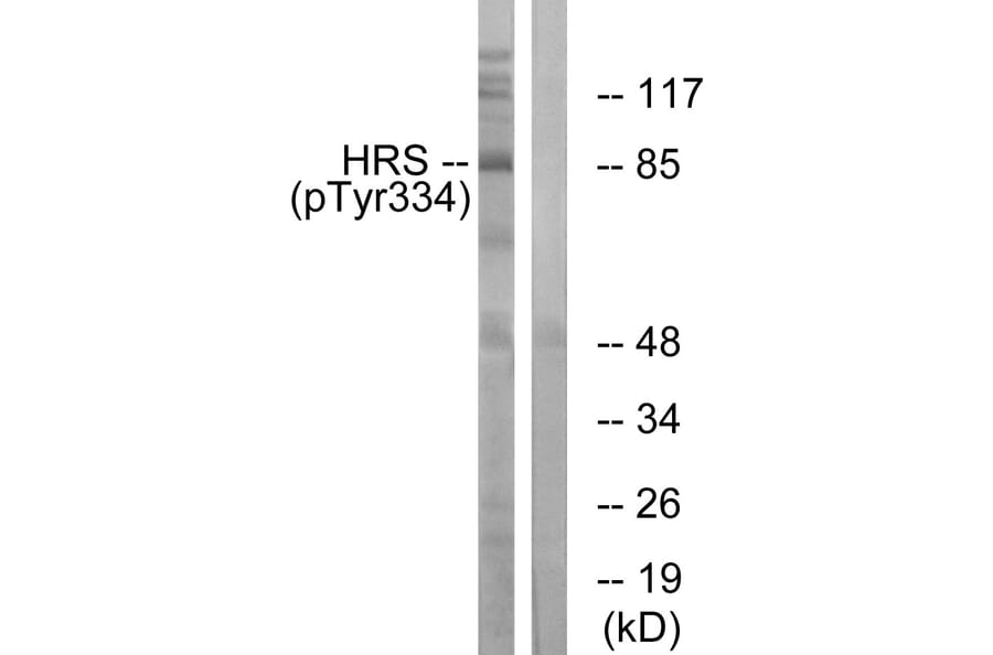 Western Blot - Anti-HRS (phospho Tyr334) Antibody (A1044) - Antibodies.com