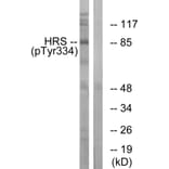 Western Blot - Anti-HRS (phospho Tyr334) Antibody (A1044) - Antibodies.com