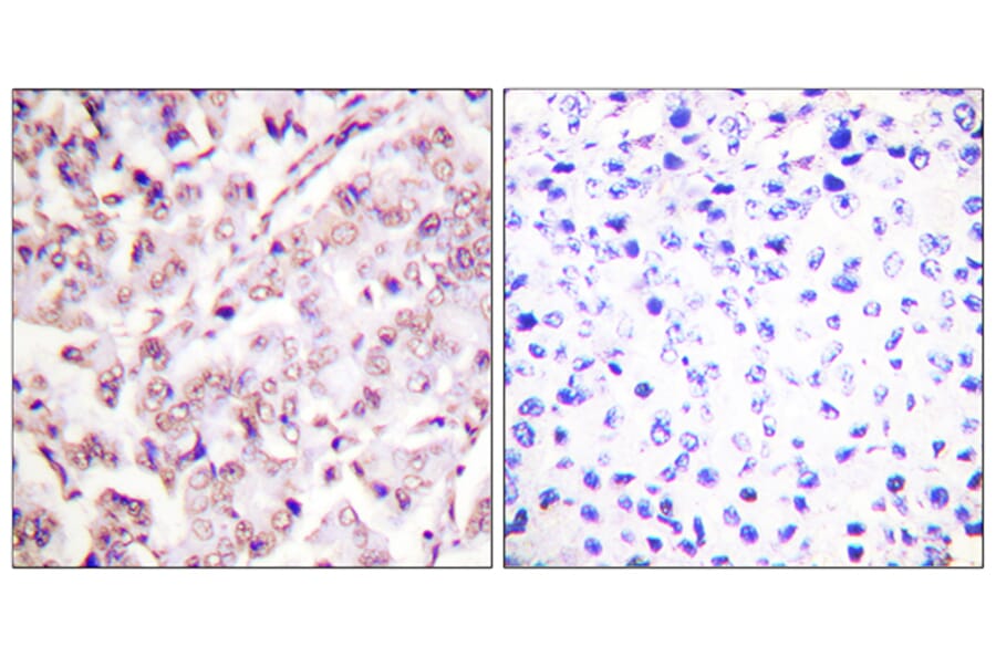 Immunohistochemistry - Anti-ETS1 (phospho Thr38) Antibody (A0478) - Antibodies.com