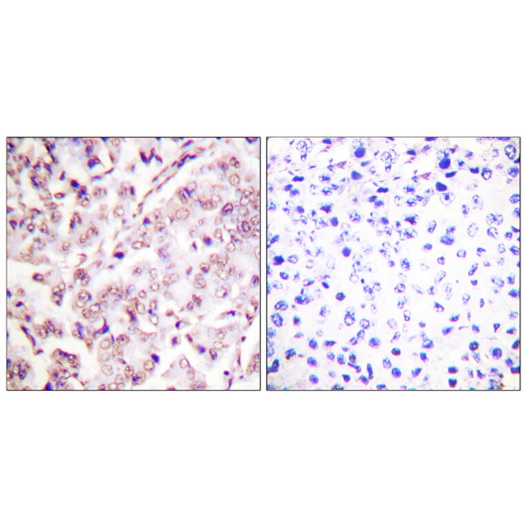 Immunohistochemistry - Anti-ETS1 (phospho Thr38) Antibody (A0478) - Antibodies.com