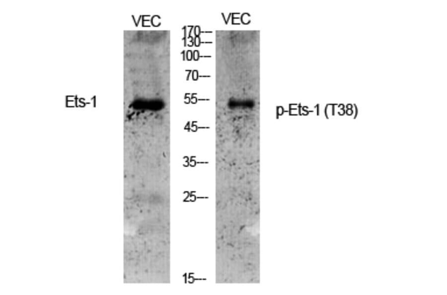 Western Blot - Anti-ETS1 (phospho Thr38) Antibody (A0478) - Antibodies.com