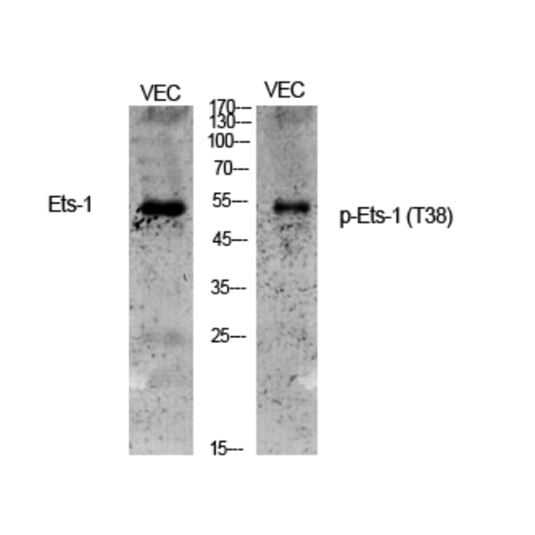 Western Blot - Anti-ETS1 (phospho Thr38) Antibody (A0478) - Antibodies.com