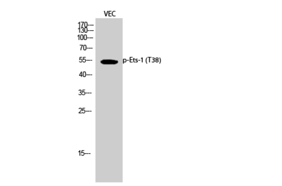 Western Blot - Anti-ETS1 (phospho Thr38) Antibody (A0478) - Antibodies.com