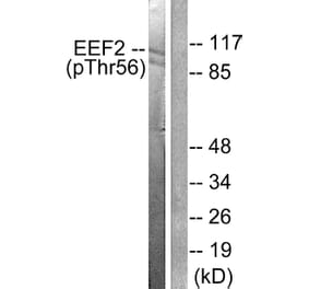 Western Blot - Anti-eEF2 (phospho Thr56) Antibody (A0070) - Antibodies.com