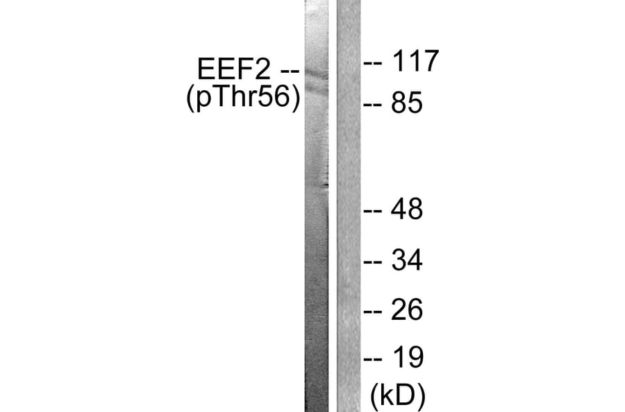 Western Blot - Anti-eEF2 (phospho Thr56) Antibody (A0070) - Antibodies.com