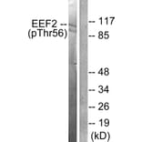 Western Blot - Anti-eEF2 (phospho Thr56) Antibody (A0070) - Antibodies.com