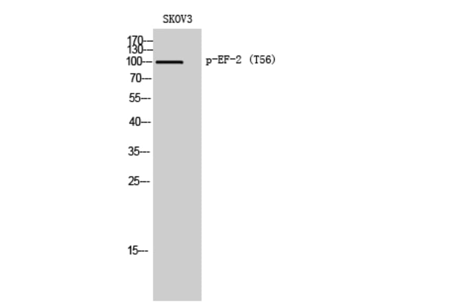 Western Blot - Anti-eEF2 (phospho Thr56) Antibody (A0070) - Antibodies.com