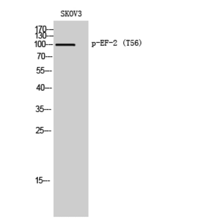 Western Blot - Anti-eEF2 (phospho Thr56) Antibody (A0070) - Antibodies.com