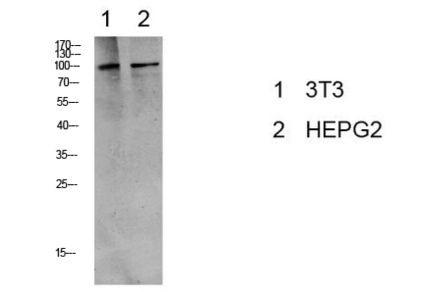 Western Blot - Anti-eEF2 (phospho Thr56) Antibody (A0070) - Antibodies.com