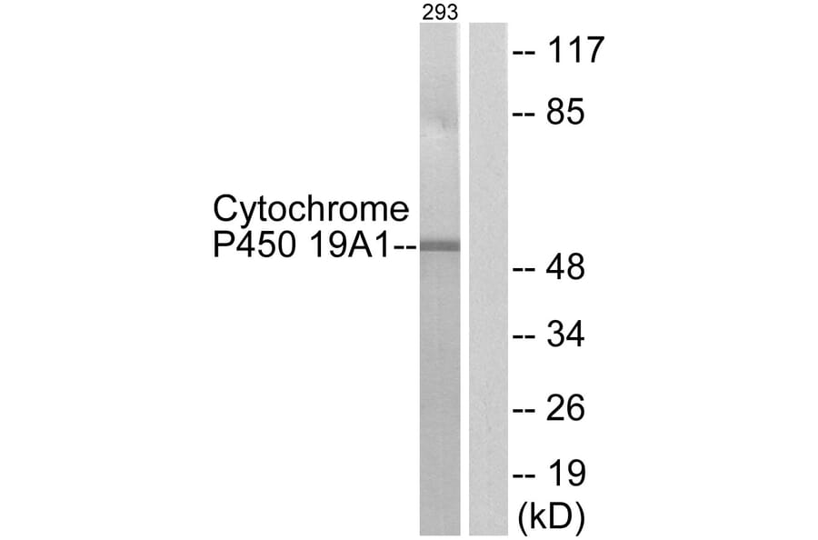 Western Blot - Anti-Cytochrome P450 19A1 Antibody (C12248) - Antibodies.com