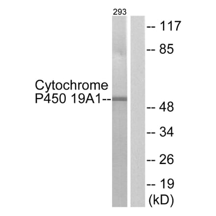 Western Blot - Anti-Cytochrome P450 19A1 Antibody (C12248) - Antibodies.com