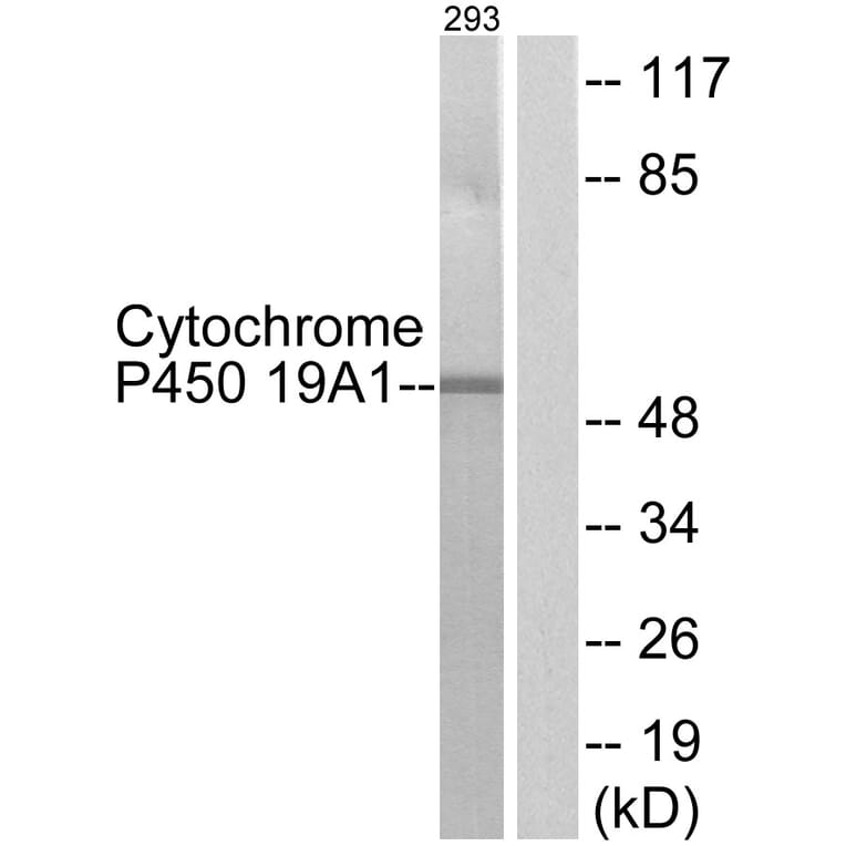 Western Blot - Anti-Cytochrome P450 19A1 Antibody (C12248) - Antibodies.com