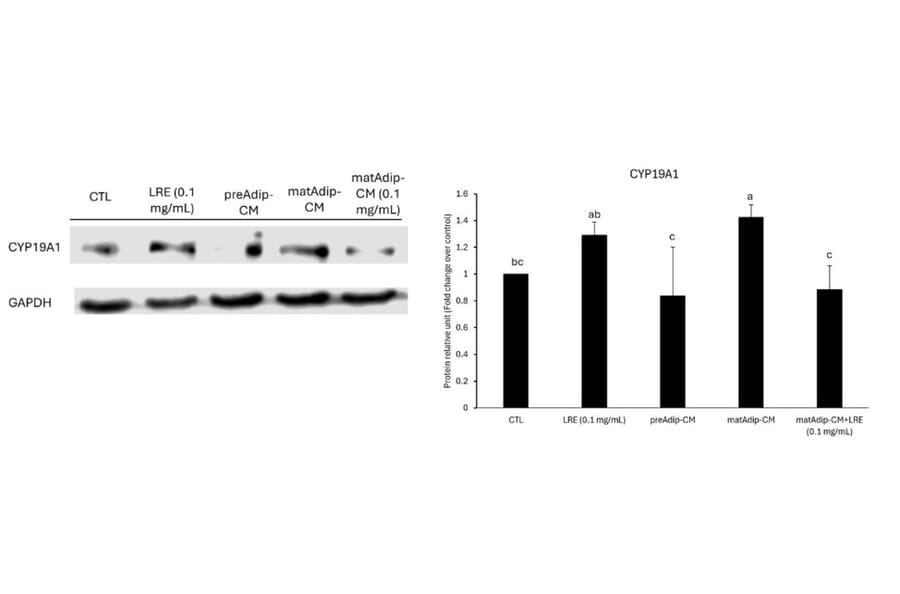Western Blot - Anti-Cytochrome P450 19A1 Antibody (A93784) - Antibodies.com Citation