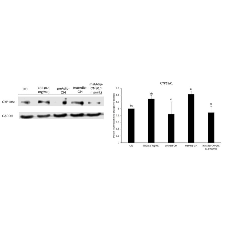 Western Blot - Anti-Cytochrome P450 19A1 Antibody (A93784) - Antibodies.com Citation