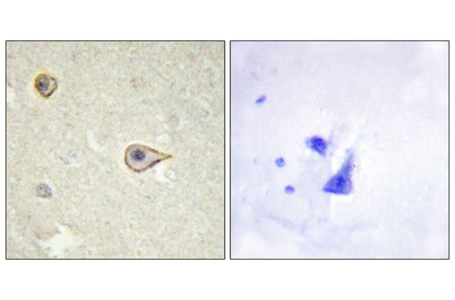 Immunohistochemistry - Anti-Cytochrome P450 19A1 Antibody (C12248) - Antibodies.com