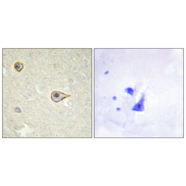 Immunohistochemistry - Anti-Cytochrome P450 19A1 Antibody (C12248) - Antibodies.com