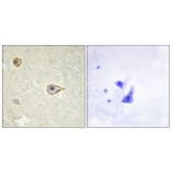 Immunohistochemistry - Anti-Cytochrome P450 19A1 Antibody (C12248) - Antibodies.com
