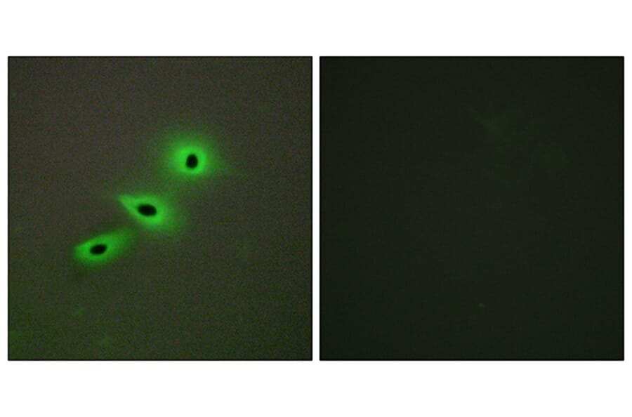 Immunofluorescence - Anti-Cytochrome P450 19A1 Antibody (C12248) - Antibodies.com