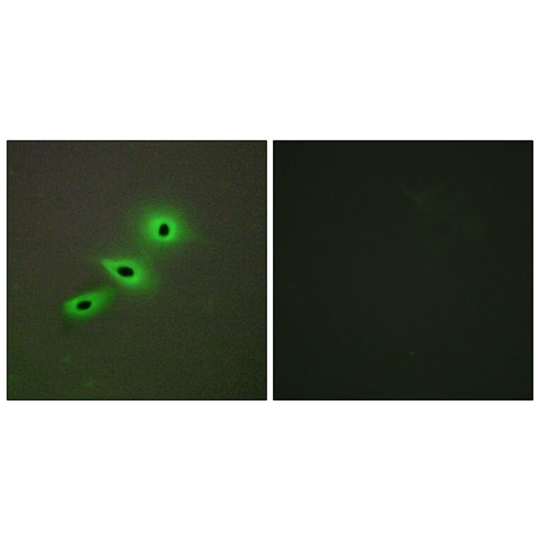 Immunofluorescence - Anti-Cytochrome P450 19A1 Antibody (C12248) - Antibodies.com