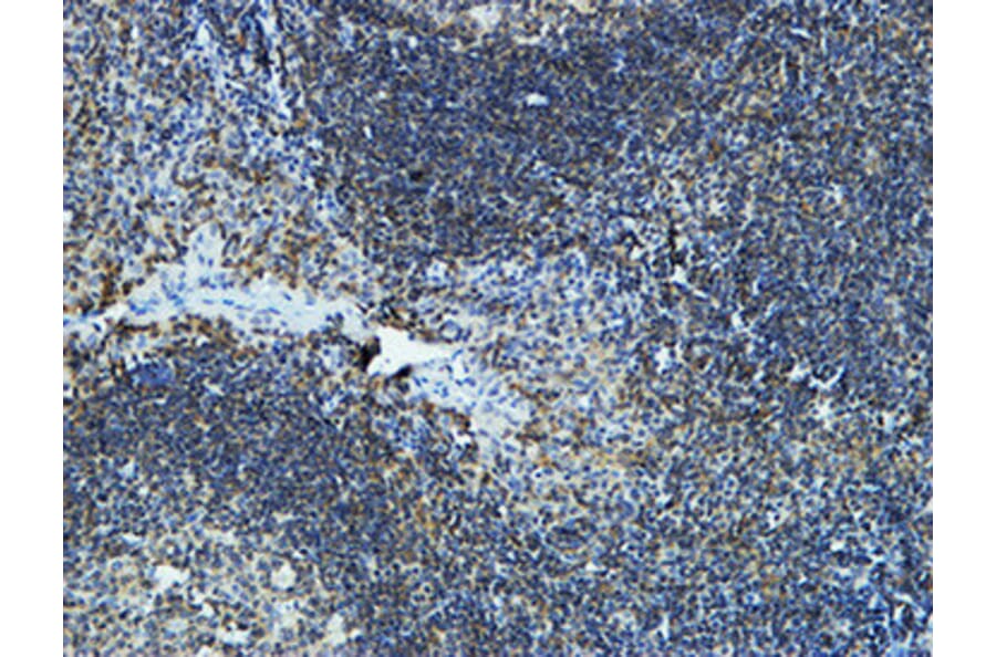 Immunohistochemistry - Anti-Cytochrome P450 19A1 Antibody (C12248) - Antibodies.com