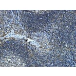 Immunohistochemistry - Anti-Cytochrome P450 19A1 Antibody (C12248) - Antibodies.com