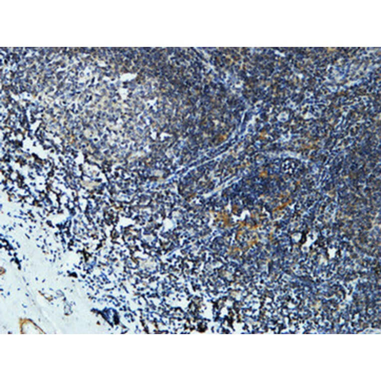 Immunohistochemistry - Anti-Cytochrome P450 19A1 Antibody (C12248) - Antibodies.com