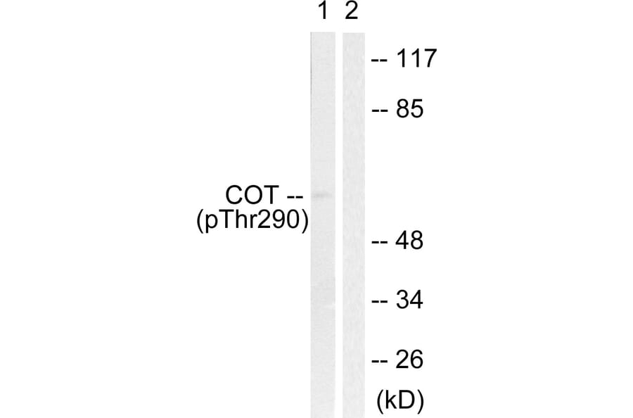 Western Blot - Anti-COT (phospho Thr290) Antibody (A0064) - Antibodies.com