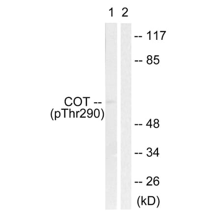 Western Blot - Anti-COT (phospho Thr290) Antibody (A0064) - Antibodies.com
