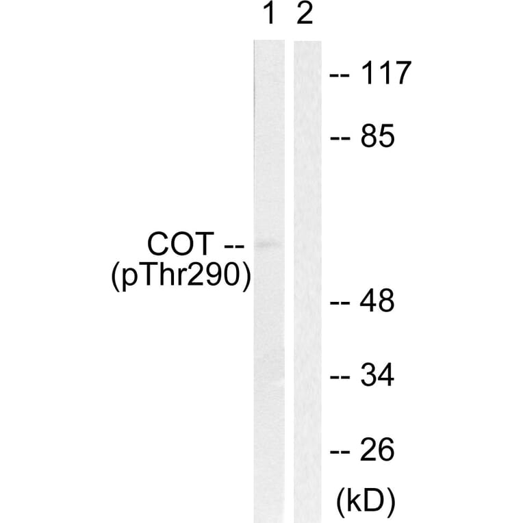 Western Blot - Anti-COT (phospho Thr290) Antibody (A0064) - Antibodies.com
