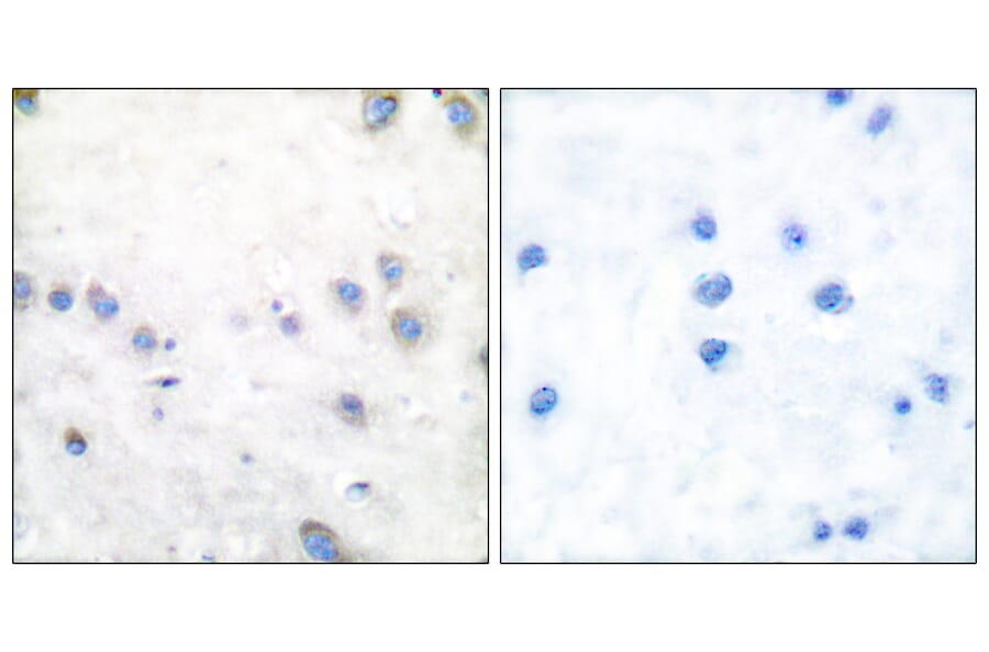 Immunohistochemistry - Anti-COT (phospho Thr290) Antibody (A0064) - Antibodies.com