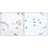 Immunohistochemistry - Anti-COT (phospho Thr290) Antibody (A0064) - Antibodies.com