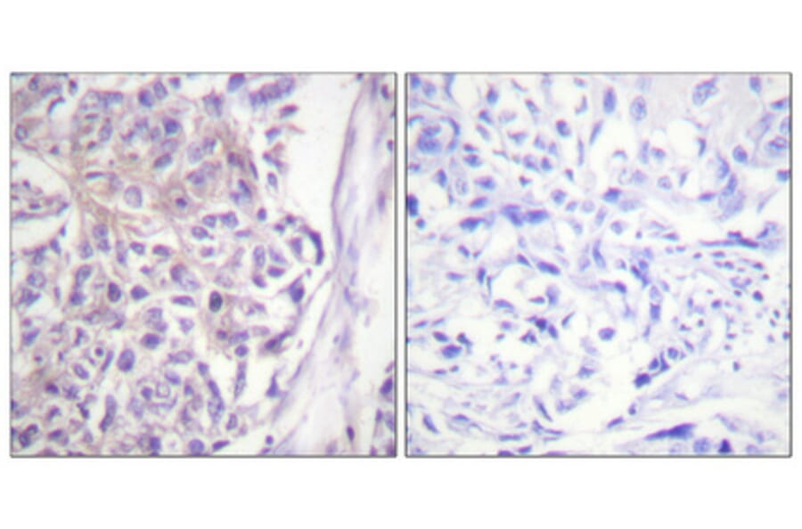Immunohistochemistry - Anti-COT (phospho Thr290) Antibody (A0064) - Antibodies.com