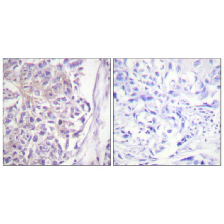 Immunohistochemistry - Anti-COT (phospho Thr290) Antibody (A0064) - Antibodies.com