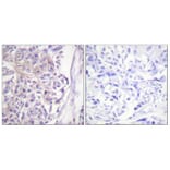 Immunohistochemistry - Anti-COT (phospho Thr290) Antibody (A0064) - Antibodies.com