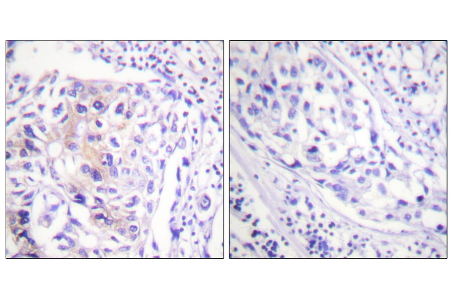 Immunohistochemistry - Anti-CBL (phospho Tyr774) Antibody (A0464) - Antibodies.com
