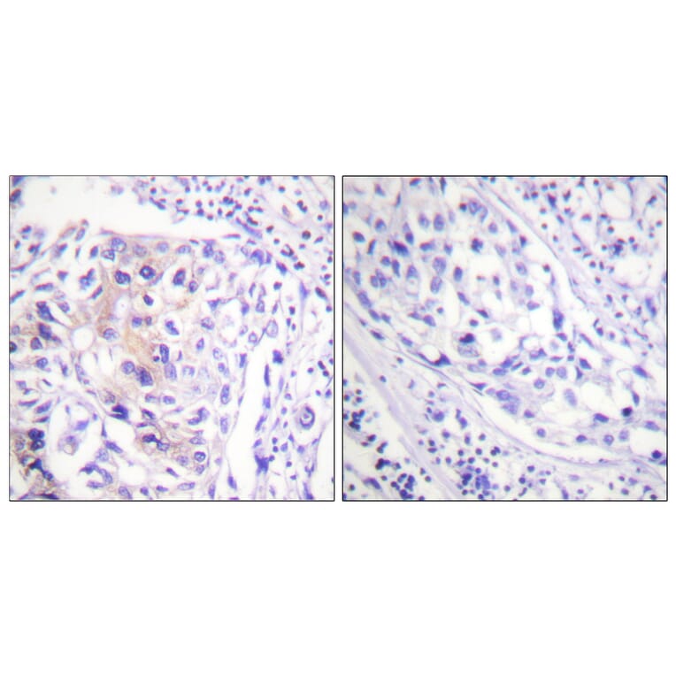 Immunohistochemistry - Anti-CBL (phospho Tyr774) Antibody (A0464) - Antibodies.com
