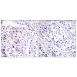 Immunohistochemistry - Anti-CBL (phospho Tyr774) Antibody (A0464) - Antibodies.com