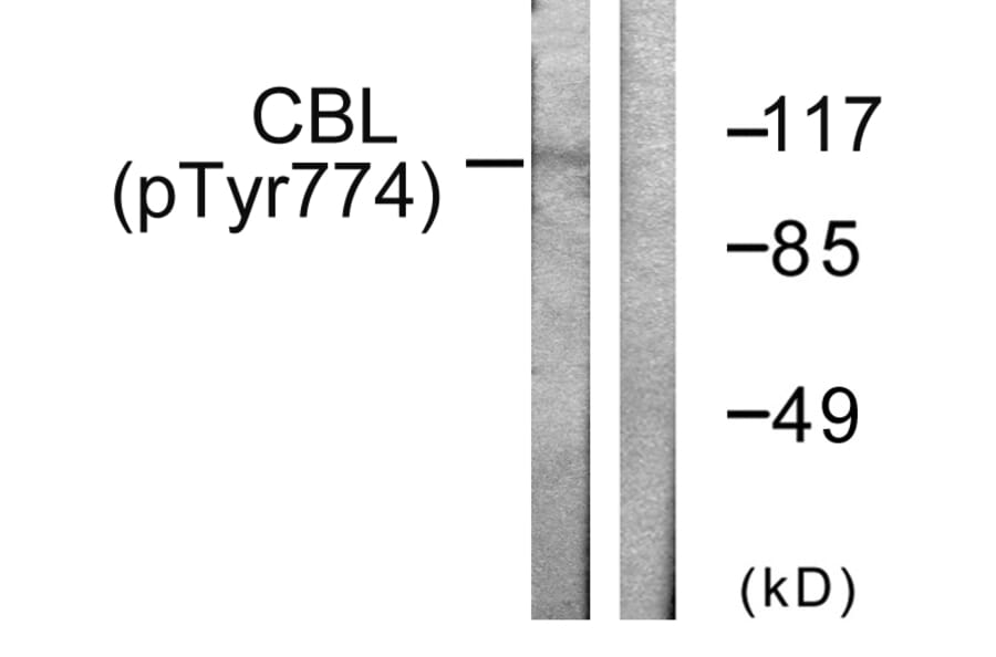 Western Blot - Anti-CBL (phospho Tyr774) Antibody (A0464) - Antibodies.com
