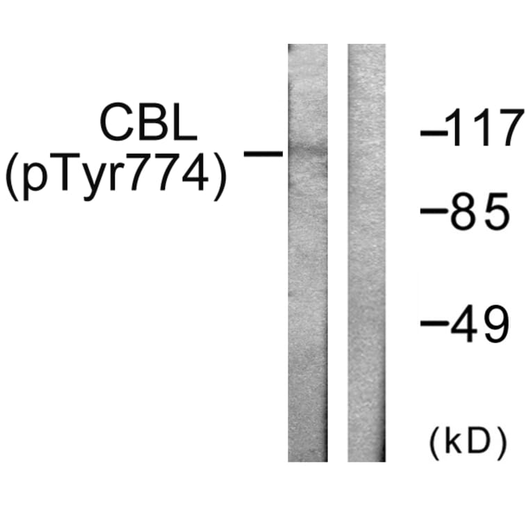 Western Blot - Anti-CBL (phospho Tyr774) Antibody (A0464) - Antibodies.com