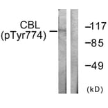 Western Blot - Anti-CBL (phospho Tyr774) Antibody (A0464) - Antibodies.com