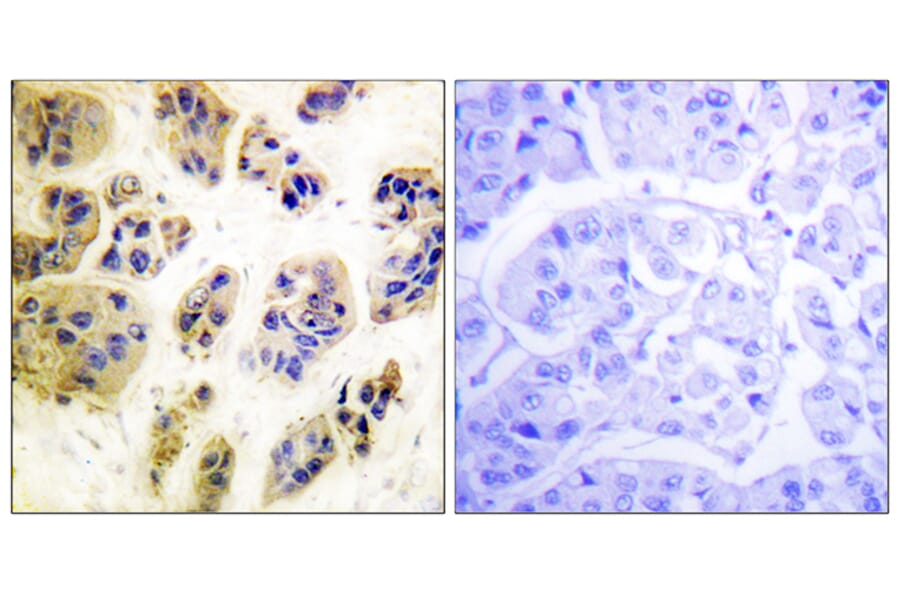 Immunohistochemistry - Anti-CBL (phospho Tyr700) Antibody (A0466) - Antibodies.com