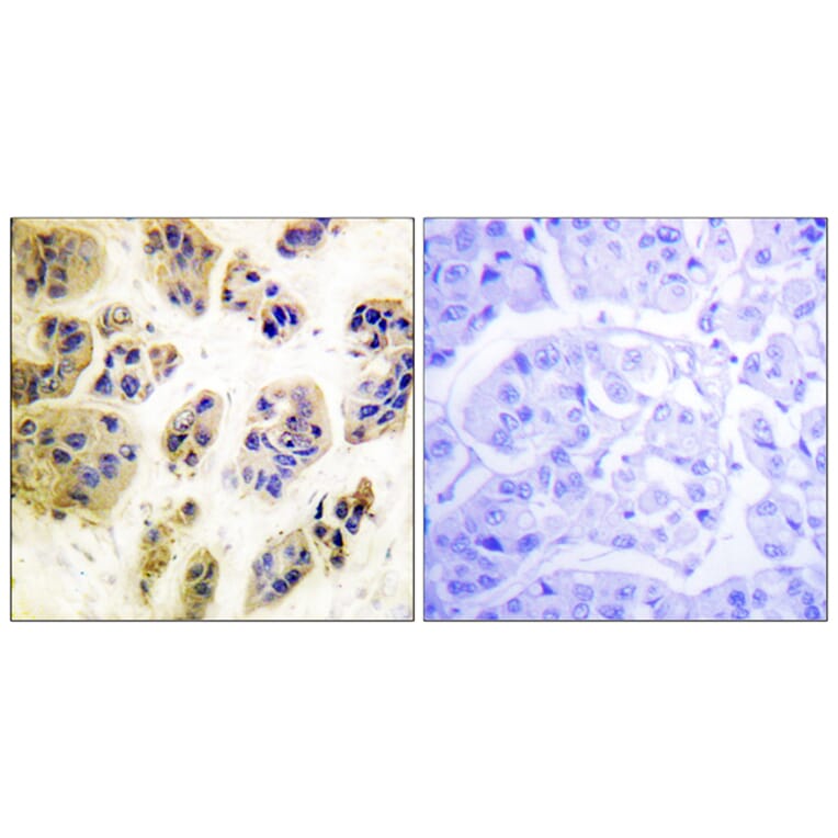 Immunohistochemistry - Anti-CBL (phospho Tyr700) Antibody (A0466) - Antibodies.com