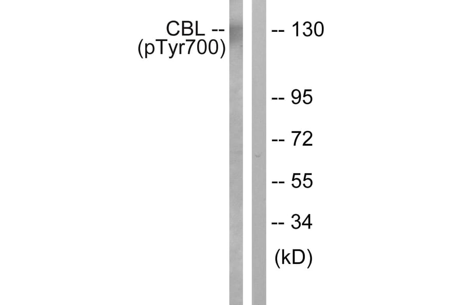 Western Blot - Anti-CBL (phospho Tyr700) Antibody (A0466) - Antibodies.com
