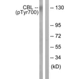 Western Blot - Anti-CBL (phospho Tyr700) Antibody (A0466) - Antibodies.com