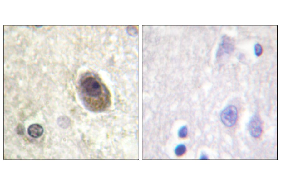 Immunohistochemistry - Anti-BAD (phospho Ser134) Antibody (A0822) - Antibodies.com