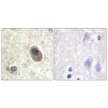 Immunohistochemistry - Anti-BAD (phospho Ser134) Antibody (A0822) - Antibodies.com