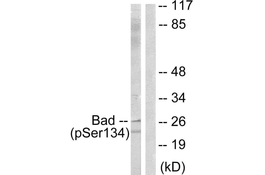 Western Blot - Anti-BAD (phospho Ser134) Antibody (A0822) - Antibodies.com