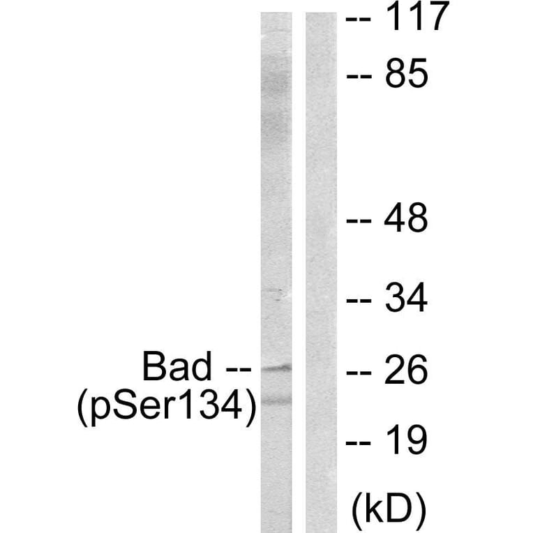 Western Blot - Anti-BAD (phospho Ser134) Antibody (A0822) - Antibodies.com